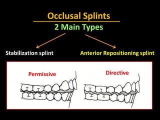 Occlusal Splints
2 Main Types
Stabilization splint Anterior Repositioning splint
Permissive Directive
 