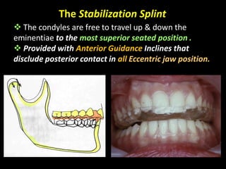 The Stabilization Splint
 The condyles are free to travel up & down the
eminentiae to the most superior seated position .
 Provided with Anterior Guidance Inclines that
disclude posterior contact in all Eccentric jaw position.
 