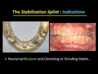  Nocturnal Bruxism and Clenching or Grinding Habits .
The Stabilization Splint : Indications
 