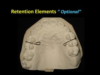 Retention Elements ” Optional”
 