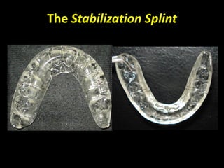 The Stabilization Splint
 