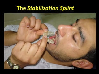 The Stabilization Splint
 
