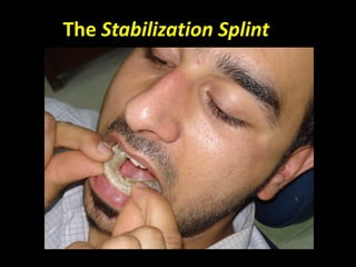 The Stabilization Splint
 