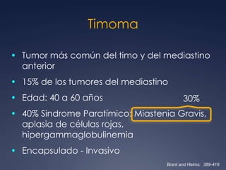 Se asocia a miastenia gravis en 65%Hiperplasia tímicaBrant and Helms:  389-416