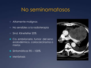 Tejidos de una o mas capasTumores germinalesBrant and Helms:  389-416