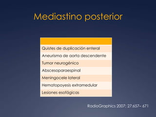 TeratocarcinomaRadioGraphics 2002; 22:S61–S78