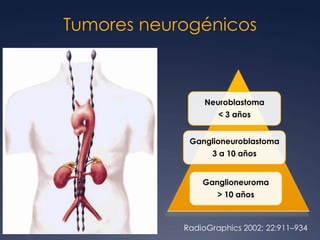 90% adultos jóvenes varones