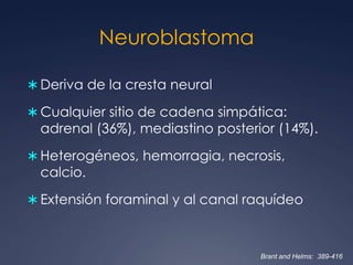 18% seminoma puroElevación de gonadotropina corionica humanaAlfa-feto proteína normalSeminoma