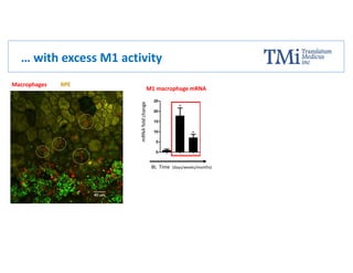Macrophages RPE
… with excess M1 activity
M1 macrophage mRNA
mRNAfoldchange
Time (days/weeks/months)BL
 