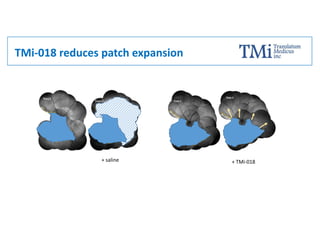 TMi-018 reduces patch expansion
+ saline + TMi-018
 