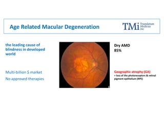 Age Related Macular Degeneration
Dry AMD
85%
Geographic atrophy (GA)
= loss of the photoreceptors & retinal
pigment epithelium (RPE)
the leading cause of
blindness in developed
world
Multi-billion $ market
No approved therapies
 