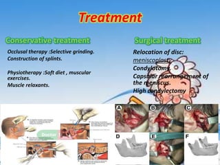 Treatment
Conservative treatment

Surgical treatment

Occlusal therapy :Selective grinding.
Construction of splints.

Relocation of disc:
meniscoplasty
Condylotomy.
Capsular rearrangement of
the meniscus.
High condylectomy

Physiotherapy :Soft diet , muscular
exercises.
Muscle relaxants.

 