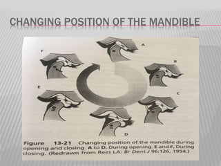 CHANGING POSITION OF THE MANDIBLE
 