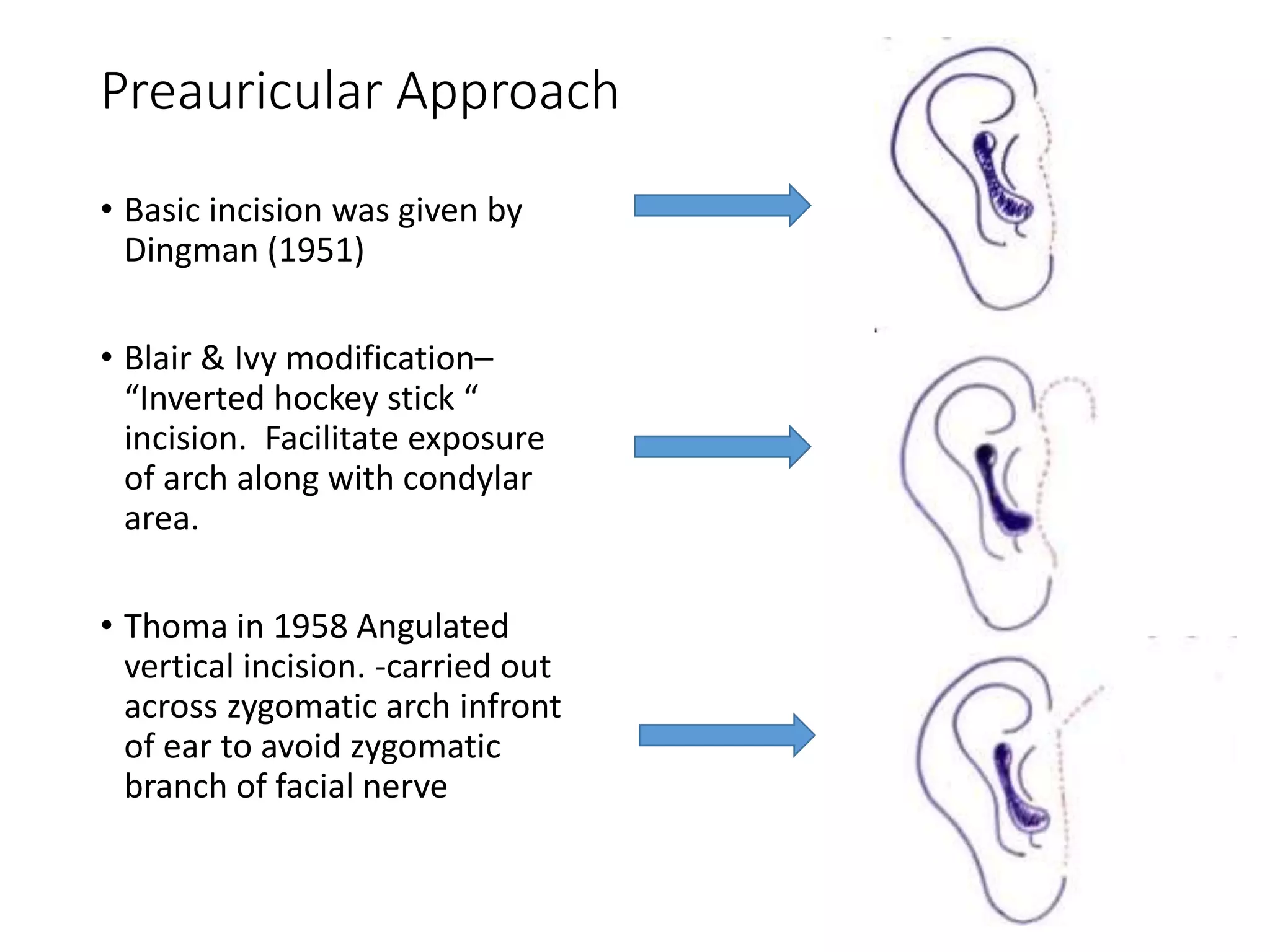 Surgical Anatomy of Temporomandibular Joint | PPTX