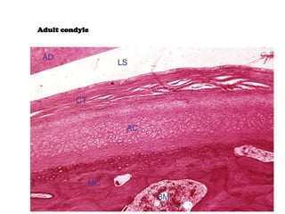 tmj tempromandibular jointanatomy and histology.pdf