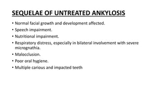 SEQUELAE OF UNTREATED ANKYLOSIS
• Normal facial growth and development affected.
• Speech impairment.
• Nutritional impairment.
• Respiratory distress, especially in bilateral involvement with severe
micrognathia.
• Malocclusion.
• Poor oral hygiene.
• Multiple carious and impacted teeth
 