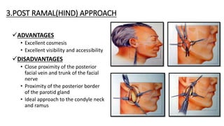 3.POST RAMAL(HIND) APPROACH
ADVANTAGES
• Excellent cosmesis
• Excellent visibility and accessibility
DISADVANTAGES
• Close proximity of the posterior
facial vein and trunk of the facial
nerve
• Proximity of the posterior border
of the parotid gland
• Ideal approach to the condyle neck
and ramus
 