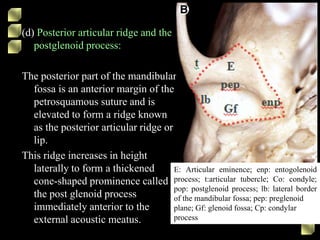 (d) Posterior articular ridge and the
postglenoid process:
The posterior part of the mandibular
fossa is an anterior margin of the
petrosquamous suture and is
elevated to form a ridge known
as the posterior articular ridge or
lip.
This ridge increases in height
laterally to form a thickened
cone-shaped prominence called
the post glenoid process
immediately anterior to the
external acoustic meatus.
E: Articular eminence; enp: entogolenoid
process; t:articular tubercle; Co: condyle;
pop: postglenoid process; lb: lateral border
of the mandibular fossa; pep: preglenoid
plane; Gf: glenoid fossa; Cp: condylar
process
 