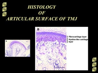 HISTOLOGY
OF
ARTICULAR SURFACE OF TMJ
 