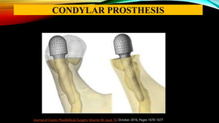 Journal of Cranio-Maxillofacial Surgery Volume 44, Issue 10, October 2016, Pages 1670-1677
CONDYLAR PROSTHESIS
 