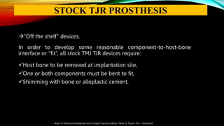 “Off the shelf” devices.
In order to develop some reasonable component-to-host-bone
interface or “fit”, all stock TMJ TJR devices require:
Host bone to be removed at implantation site,
One or both components must be bent to fit,
Shimming with bone or alloplastic cement.
Atlas of Temporomandibular Joint Surgery, Second edition, Peter D. Quinn, Eric J. Granquist
STOCK TJR PROSTHESIS
 