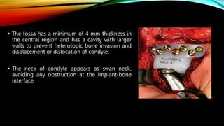 • The fossa has a minimum of 4 mm thickness in
the central region and has a cavity with larger
walls to prevent heterotopic bone invasion and
displacement or dislocation of condyle.
• The neck of condyle appears as swan neck,
avoiding any obstruction at the implant-bone
interface
 