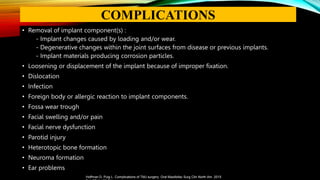 • Removal of implant component(s) :
- Implant changes caused by loading and/or wear.
- Degenerative changes within the joint surfaces from disease or previous implants.
- Implant materials producing corrosion particles.
• Loosening or displacement of the implant because of improper fixation.
• Dislocation
• Infection
• Foreign body or allergic reaction to implant components.
• Fossa wear trough
• Facial swelling and/or pain
• Facial nerve dysfunction
• Parotid injury
• Heterotopic bone formation
• Neuroma formation
• Ear problems
Hoffman D, Puig L. Complications of TMJ surgery. Oral Maxillofac Surg Clin North Am. 2015
COMPLICATIONS
 
