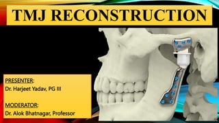 TMJ RECONSTRUCTION
PRESENTER:
Dr. Harjeet Yadav, PG III
MODERATOR:
Dr. Alok Bhatnagar, Professor
 