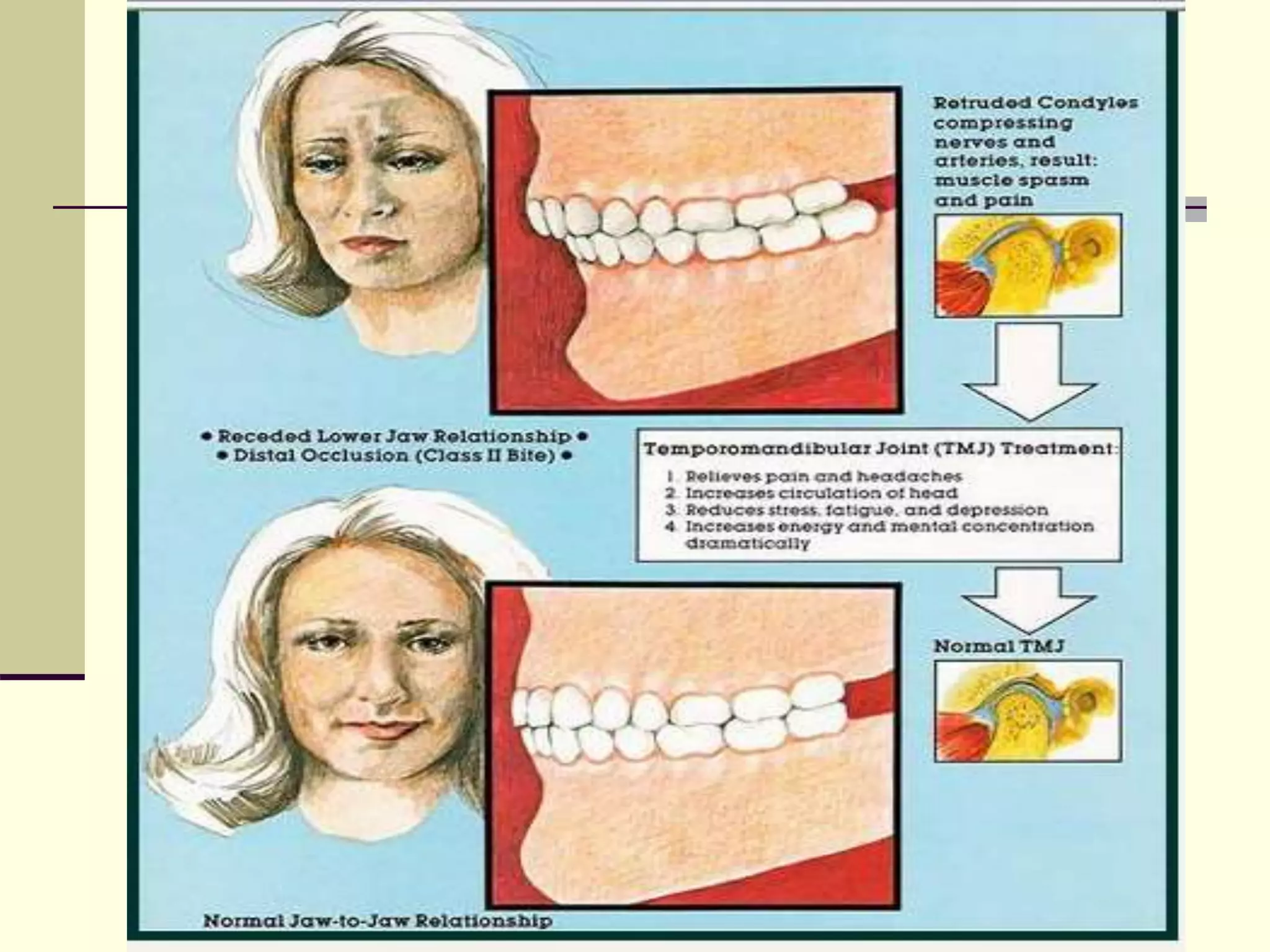 examination of temporomandibular joint disorders in orthodontic ...