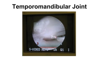 Temporomandibular Joint
 