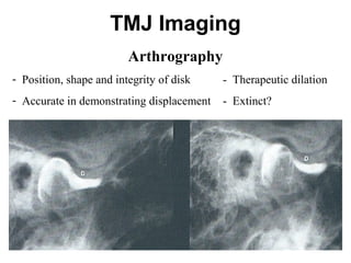 Tmj Radiograph Positioning TMJ Anatomy | PPT