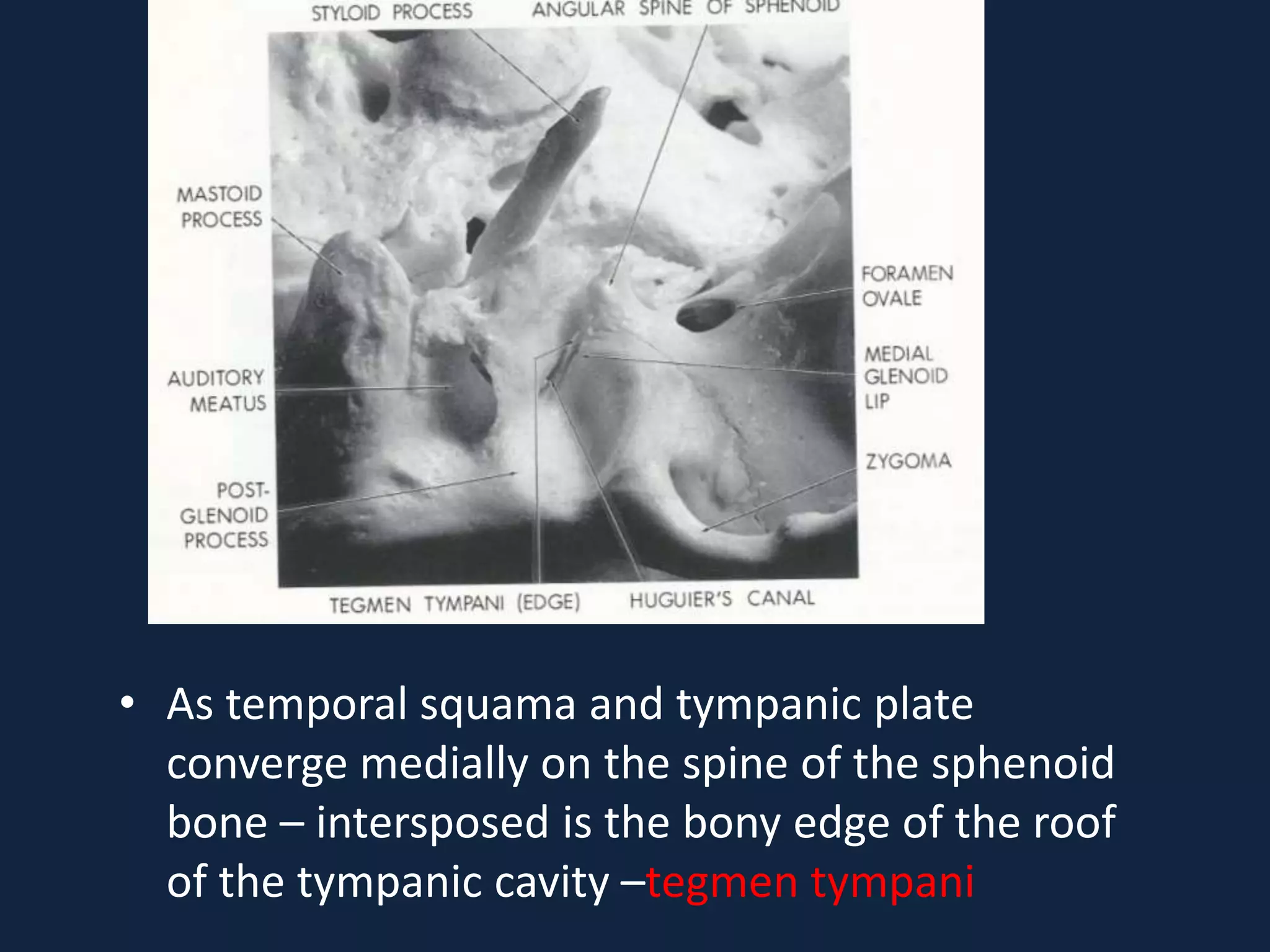 Tmj anatomy | PPTX