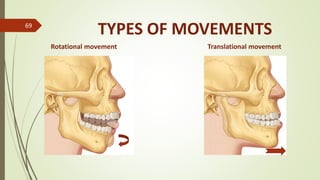 Tmj Over Rotation TMJ Anatomy and TMD | PPTX