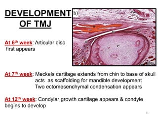 DEVELOPMENT
OF TMJ
At 6th week: Articular disc
first appears
At 7th week: Meckels cartilage extends from chin to base of skull
acts as scaffolding for mandible development
Two ectomesenchymal condensation appears
At 12th week: Condylar growth cartilage appears & condyle
begins to develop
11
 