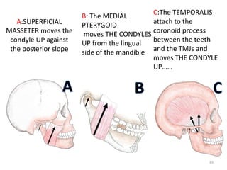 A:SUPERFICIAL
MASSETER moves the
condyle UP against
the posterior slope
C:The TEMPORALIS
attach to the
coronoid process
between the teeth
and the TMJs and
moves THE CONDYLE
UP……
B: The MEDIAL
PTERYGOID
moves THE CONDYLES
UP from the lingual
side of the mandible
89
 