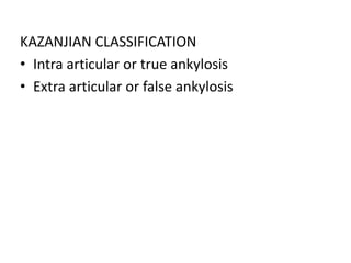KAZANJIAN CLASSIFICATION
• Intra articular or true ankylosis
• Extra articular or false ankylosis
 