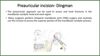 Tmj ankylosis | PPTX