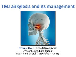 Presented by: Dr Dibya Falgoon Sarkar
3rd year Postgraduate student
Department of Oral & Maxillofacial Surgery
 
