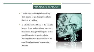  The incidence of ankylosis resulting
from trauma is less frequent in adults
than it is in children
 In adult the cortical bone of the condyle
is more dense and neck is narrow, force
transmitted through the long axis of the
mandible results in a subcondylar
fracture or fracture discoloration of the
condyle rather than an intracapsular
fracture.
ANKYLOSIS IN ADULT
 