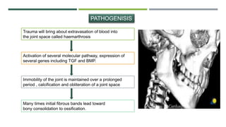 PATHOGENISIS
Trauma will bring about extravasation of blood into
the joint space called haemarthrosis
Immobility of the joint is maintained over a prolonged
period , calcification and obliteration of a joint space
Many times initial fibrous bands lead toward
bony consolidation to ossification.
Activation of several molecular pathway, expression of
several genes including TGF and BMP.
 