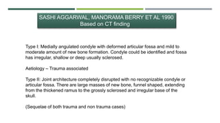 SASHI AGGARWAL, MANORAMA BERRY ET AL 1990
Based on CT finding
Type I: Medially angulated condyle with deformed articular fossa and mild to
moderate amount of new bone formation. Condyle could be identified and fossa
has irregular, shallow or deep usually sclerosed.
Aetiology – Trauma associated
Type II: Joint architecture completely disrupted with no recognizable condyle or
articular fossa. There are large masses of new bone, funnel shaped, extending
from the thickened ramus to the grossly sclerosed and irregular base of the
skull.
(Sequelae of both trauma and non trauma cases)
 