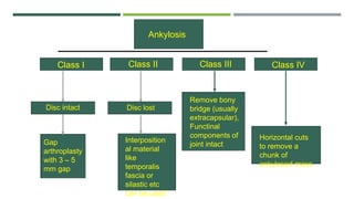 Ankylosis
Class I Class II Class III Class IV
Disc lost
Disc intact
Gap
arthroplasty
with 3 – 5
mm gap
Interposition
al material
like
temporalis
fascia or
silastic etc
can be used
Remove bony
bridge (usually
extracapsular),
Functinal
components of
joint intact
Horizontal cuts
to remove a
chunk of
ankylosed mass
 