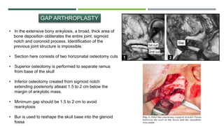 GAP ARTHROPLASTY
• In the extensive bony ankylosis, a broad, thick area of
bone deposition obliterates the entire joint, sigmoid
notch and coronoid process. Identification of the
previous joint structure is impossible.
• Section here consists of two horizonatal osteotomy cuts
• Superior osteotomy is performed to separate ramus
from base of the skull
• Inferior osteotomy created from sigmoid notch
extending posteriorly atleast 1.5 to 2 cm below the
margin of ankylotic mass.
• Minimum gap should be 1.5 to 2 cm to avoid
reankylosis
• Bur is used to reshape the skull base into the glenoid
fossa
 