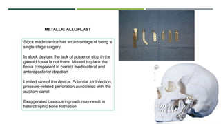 METALLIC ALLOPLAST
Stock made device has an advantage of being a
single stage surgery.
In stock devices the lack of posterior stop in the
glenoid fossa is not there. Missed to place the
fossa component in correct mediolateral and
anteroposterior direction
Limited size of the device. Potential for infection,
pressure-related perforation associated with the
auditory canal
Exaggerated osseous ingrowth may result in
heterotrophic bone formation
 