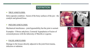  TRUE ANKYLOSIS:
Intra-capsular condition - fusion of the bony surfaces of the jaw - the
condyle and glenoid fossa.
 PSEUDO ANKYLOSIS:
Mechanical interference - joint hypomobility but the joint is normal.
Examples - Fibrous ankylosis, Coronoid hyperplasia or Fusion of
coronoid process with the tuberosity of Maxilla or zygoma.
 FALSE ANKYLOSIS
Damage to the tissues directly adjacent to the joint from trauma,
infection or radiation.
DEFINITION
 