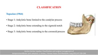 Coronoid Classification TMJ ankylosis and reconstruction.pptx