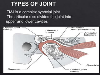 Greater Multangular Joint Tmj by dr.meher moin | PPTX