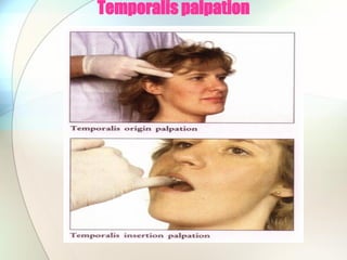 Temporalis palpation
 