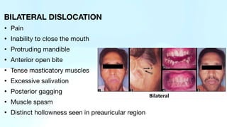 BILATERAL DISLOCATION
• Pain
• Inability to close the mouth
• Protruding mandible
• Anterior open bite
• Tense masticatory muscles
• Excessive salivation
• Posterior gagging
• Muscle spasm
• Distinct hollowness seen in preauricular region
 