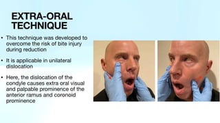 • This technique was developed to
overcome the risk of bite injury
during reduction
• It is applicable in unilateral
dislocation
• Here, the dislocation of the
condyle causes extra oral visual
and palpable prominence of the
anterior ramus and coronoid
prominence
EXTRA-ORAL
TECHNIQUE
 